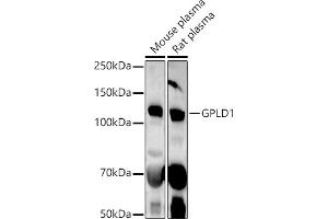 Western blot analysis of extracts of various cell lines, using GPLD1 antibody (ABIN6131716, ABIN6141335, ABIN6141336 and ABIN6222300) at 1:1000 dilution.