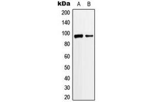 Western blot analysis of ANKRD20A3 expression in Jurkat (A), K562 (B) whole cell lysates. (ANKRD20A3 antibody  (Center))
