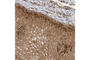 Immunohistochemical staining of human esophagus with NAF1 polyclonal antibody  shows strong nuclear and cytoplasmic positivity in squamous epithelial cells at 1:50-1:200 dilution. (NAF1 antibody)