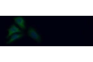 Detection of PKLR in Human HepG2 cell using Polyclonal Antibody to Pyruvate kinase isozymes R/L (PKLR) (PKLR antibody  (AA 219-420))