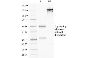 SDS-PAGE Analysis Purified CDX2 Mouse Monoclonal Antibody (CDX2/1690). (CDX2 antibody  (AA 150-249))