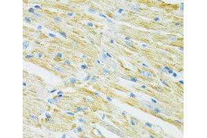 Immunohistochemistry of paraffin-embedded Mouse heart using SLC19A1 Polyclonal Antibody at dilution of 1:100 (40x lens). (SLC19A1 antibody)