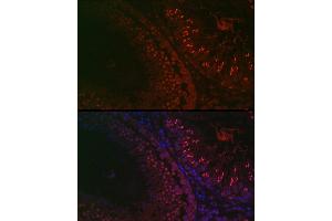 Immunofluorescence (IF) image for anti-Deleted in Azoospermia-Like (DAZL) (AA 186-295) antibody (ABIN6139416)
