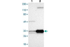 Western blot analysis of Lane 1: Human cell line RT-4, Lane 2: Human cell line U-251MG sp with ECH1 polyclonal antibody .