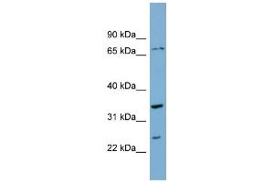 WB Suggested Anti-PDP2 Antibody Titration: 0. (PDP2 antibody  (Middle Region))