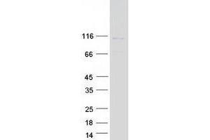 Validation with Western Blot (USP33 Protein (Transcript Variant 2) (Myc-DYKDDDDK Tag))