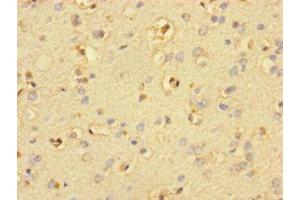 Immunohistochemistry of paraffin-embedded human brain tissue using ABIN7169856 at dilution of 1:100 (SMIM19 antibody  (AA 44-107))
