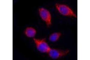 Immunofluorescence (IF) image for anti-Keratin 18 (KRT18) antibody (ABIN2664917) (Cytokeratin 18 antibody)