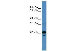 BASP1 antibody used at 0. (BASP1 antibody  (N-Term))