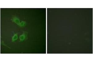 Immunofluorescence analysis of HeLa cells, using Amyloid beta A4 (Ab-743/668) Antibody. (APP antibody  (AA 711-760))