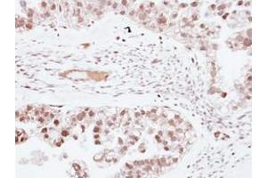 Image no. 1 for anti-Zinc Finger Protein 501 (ZNF501) (AA 67-271) antibody (ABIN1501846) (ZNF501 antibody  (AA 67-271))