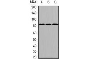 Western blot analysis of ALOXE3 expression in MCF7 (A), mouse testis (B), rat intestine (C) whole cell lysates. (ALOXE3 antibody)