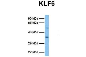 Host:  Rabbit  Target Name:  KLF6  Sample Tissue:  Human Fetal Liver  Antibody Dilution:  1. (KLF6 antibody  (N-Term))