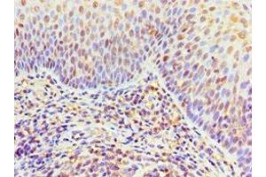 Immunohistochemistry of paraffin-embedded human tonsil tissue using ABIN7156454 at dilution of 1:100 (ITGA9 antibody  (AA 30-250))