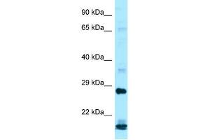 Western Blotting (WB) image for anti-Interferon, alpha 16 (IFNA16) (C-Term) antibody (ABIN2490352) (IFNA16 antibody  (C-Term))