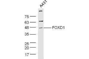 Human A431 cell lysates probed with Rabbit Anti-Pan FOXD Polyclonal Antibody, Unconjugated  at 1:500 for 90 min at 37˚C.