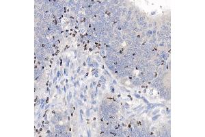 Immunohistochemistry (IHC) image for anti-IKAROS Family Zinc Finger 3 (Aiolos) (IKZF3) antibody (ABIN7267842)