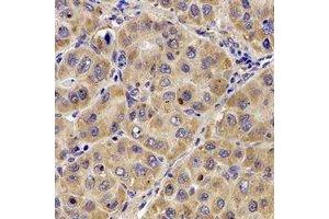 Immunohistochemical analysis of Complement C7 staining in human liver formalin fixed paraffin embedded tissue section. (C7 antibody  (N-Term))