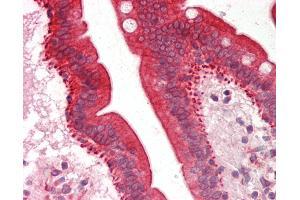 Immunohistochemistry (IHC) image for anti-Cytochrome P450, Family 3, Subfamily A, Polypeptide 5 (CYP3A5) (AA 83-132) antibody (ABIN6755350)