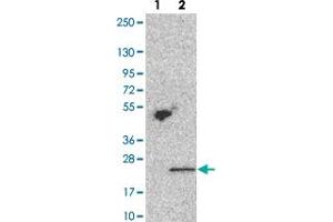 Western blot analysis of Lane 1: Negative control (vector only transfected HEK293T lysate). (TMEM69 antibody)
