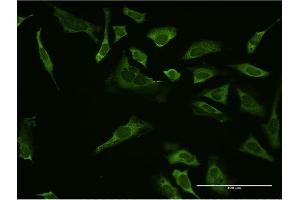 Immunofluorescence of monoclonal antibody to SP1 on HeLa cell. (SP1 antibody  (AA 522-618))