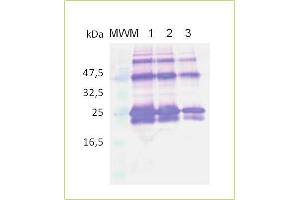 Analysis of rhuman sRANKL with specific antibody by Western Blot, Lane MWM: Molecular weight marker (kDa), lane 1 contains 1 lane 2 contains 0.