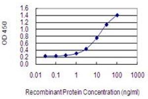 Detection limit for recombinant GST tagged MYO6 is 0. (Myosin VI antibody  (AA 1188-1285))