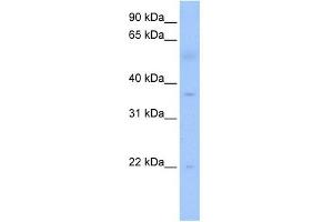 RG9MTD3 antibody used at 1 ug/ml to detect target protein. (RG9MTD3 antibody)