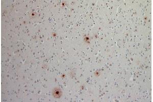Indirect immunostaining of a PFA fixed, formic acid trated paraffin embedded cortex section from a sporadic Alzheimer´s disease patient (dilution 1 : 200). (Abeta 1-42 antibody)