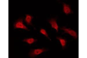 ABIN6276016 staining Hela by IF/ICC. (GPR153 antibody  (Internal Region))