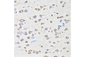 Immunohistochemistry of paraffin-embedded rat brain using COPB2 antibody (ABIN5974232) at dilution of 1/100 (40x lens). (COPB2 antibody)
