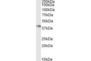 Western Blotting (WB) image for anti-Receptor Tyrosine-Protein Kinase ErbB-3 (ERBB3) antibody (ABIN2779309) (ERBB3 antibody)