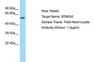 Image no. 1 for anti-butyrophilin, Subfamily 2, Member A2 (BTN2A2) (AA 64-113) antibody (ABIN6750158) (BTN2A2 antibody  (AA 64-113))