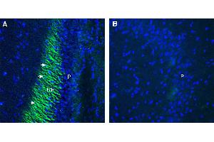 Expression of Plexin-A4 in rat hippocampus.
