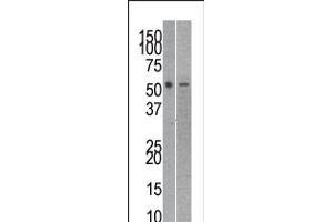 Antibody is used in Western blot to detect RUVBL2 in mouse kidney (left) and SK-Br-3 (right) tissue/cell line lysates. (Reptin,TIP49B,RUVB2 (AA 400-430), (C-Term) antibody)