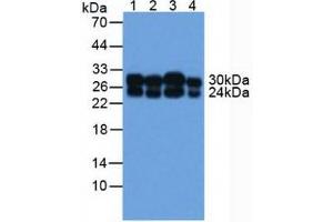 Figure. (COMT antibody  (AA 52-271))