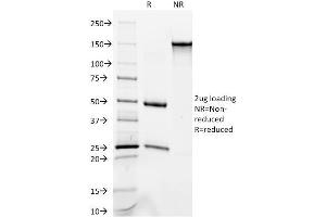 SDS-PAGE Analysis Purified Cytokeratin 8/18 Monoclonal Antibody (C-51). (KRT8, KRT18 antibody)