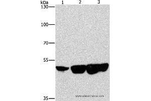 Western blot analysis of Hela, hepG2 and 231 cell, using CTBP2 Polyclonal Antibody at dilution of 1:400