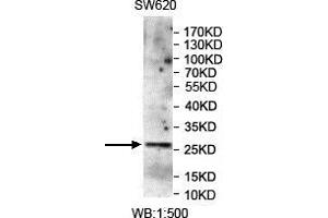 WB analysis of SW620 lysates, using CMTM4 antibody.
