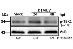 Western Blotting (WB) image for anti-TANK-Binding Kinase 1 (TBK1) (pSer172) antibody (ABIN746363)