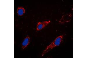 Immunofluorescent analysis of EPAC1 staining in A549 cells. (RAPGEF3 antibody  (C-Term))