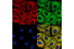 pan Actin Mouse Monoclonal Antibody staining HepG2 cells by IF/ICC.
