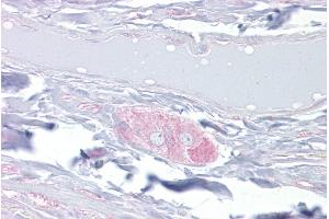 Immunohistochemistry with Small intestine, submucosal plexus tissue at an antibody concentration of 10µg/ml using anti-DPYSL3 antibody (ARP51962_P050) (DPYSL3 antibody  (Middle Region))