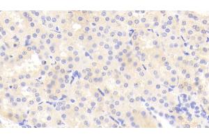 Detection of TNC in Human Kidney Tissue using Polyclonal Antibody to Tenascin C (TNC) (TNC antibody  (AA 49-181))