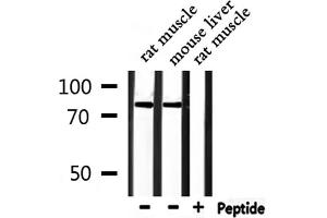 Western blot analysis of extracts from rat muscle,mouse liver, using RALBP1 Antibody. (RALBP1 antibody  (N-Term))