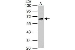 WB Image Sample (30 ug of whole cell lysate) A: U87-MG 10% SDS PAGE antibody diluted at 1:1000 (CAMKK2 antibody  (N-Term))