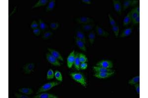 Immunofluorescent analysis of HepG2 cells using ABIN7147586 at dilution of 1:100 and Alexa Fluor 488-congugated AffiniPure Goat Anti-Rabbit IgG(H+L) (CLIC2 antibody  (AA 53-247))