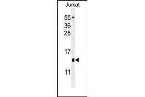 Western blot analysis of H2AFZ Antibody (C-term) in Jurkat cell line lysates (35ug/lane).