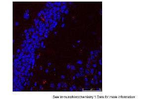 Sample Type: Mouse Brain Slices Red: primaryBlue: DAPIPrimary Dilution: 1:400 Secondary Antibody: Anti-Rabbit IgG Alexa 594Secondary Dilution: 1:400 Image Submitted By: Adahir Labrador-Garrido and Cintia Roodveldt University of Seville (HSPA9 antibody  (C-Term))