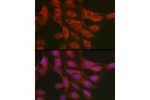 Immunofluorescence analysis of C6 cells using GART Rabbit pAb (ABIN1679954, ABIN3018225, ABIN3018226 and ABIN6220407) at dilution of 1:200 (40x lens). (GART antibody  (AA 1-320))